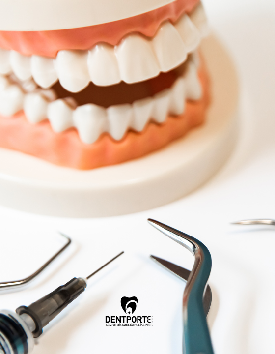 Dentporte | Tedavilerimiz | Periodontoloji