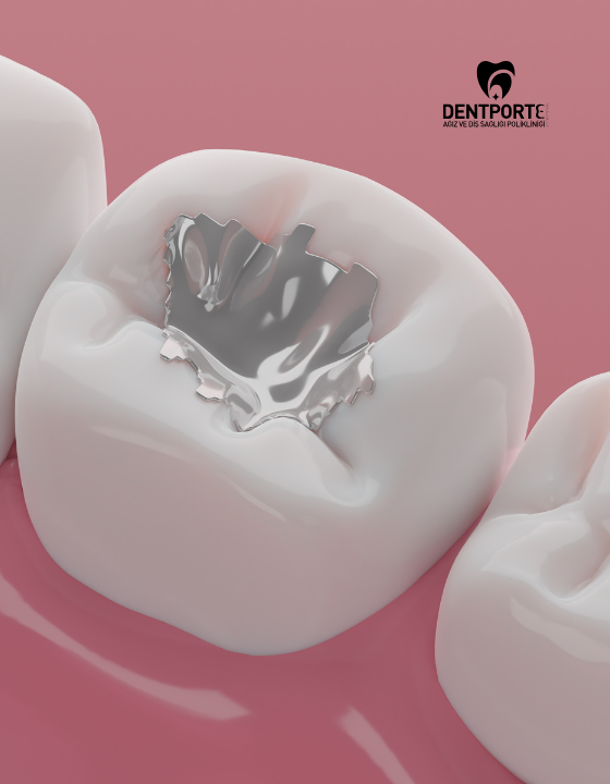 Dentporte | Tedavilerimiz | Smart Protokolü