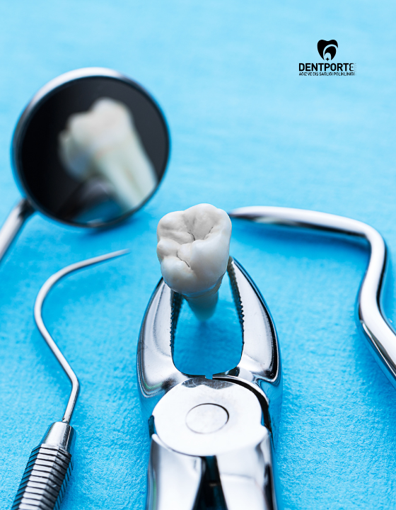 Dentporte | Tedavilerimiz | Diş Çekimi